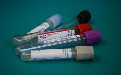How Does Ordering Blood Tests Online Work?